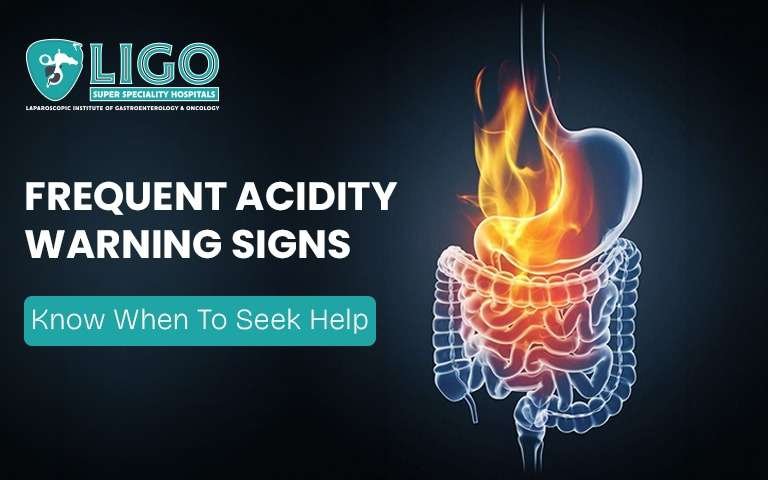 Why Frequent Acidity Should Not Be Ignored